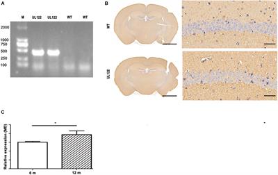 Human Cytomegalovirus Immediate Early Protein 2 Protein Causes Cognitive Disorder by Damaging Synaptic Plasticity in Human Cytomegalovirus-UL122-Tg Mice